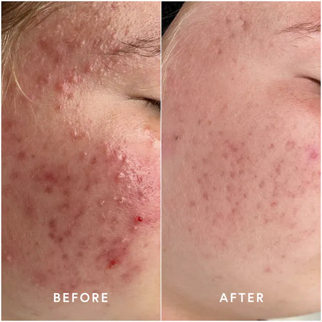 Epicutis Lipid Serum