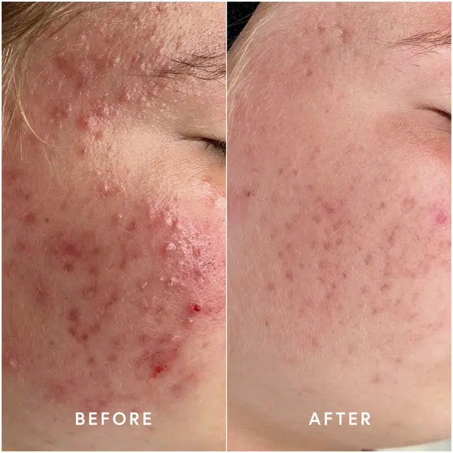 EPICUTIS HYDROBIOME MIST - Brandy Watkins Beauty