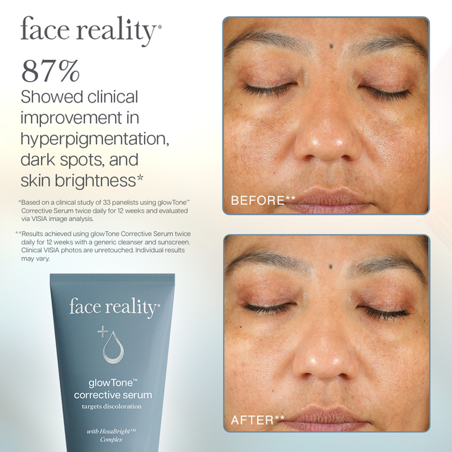 Face Reality GLOWTONE™ CORRECTIVE SERUM - Brandy Watkins Beauty